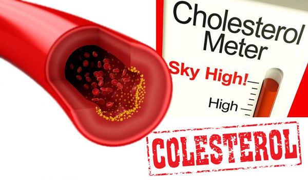 Tahap Kolesterol: Apa yang Perlu Anda Ketahui